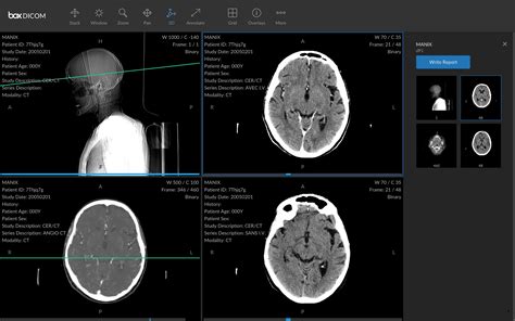 Managing and Viewing DICOM Images .